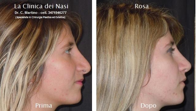 La Clinica Dei Nasi Dott Carmine Martino C P Estheticon It