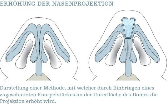 Projektion der Nase, Länge der Nasenbasis | Estheticon.de