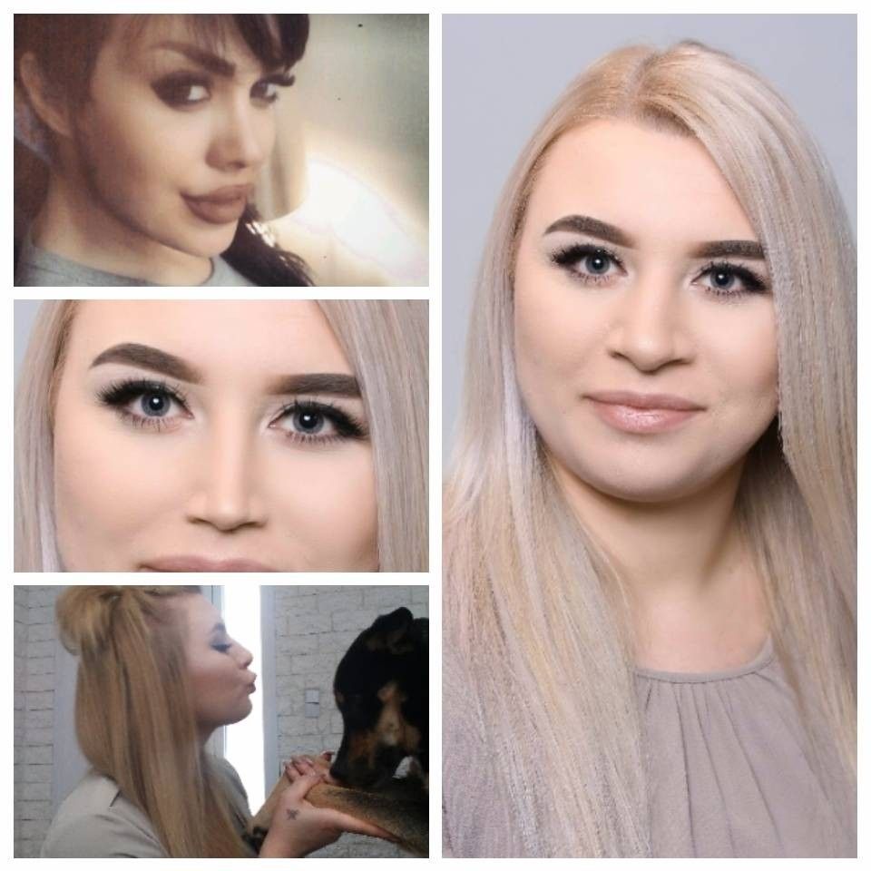 Gerade Feminine Nase Durch Nasenkorrektur Nasenkorrektur Rhinoplastik Forum Estheticon De