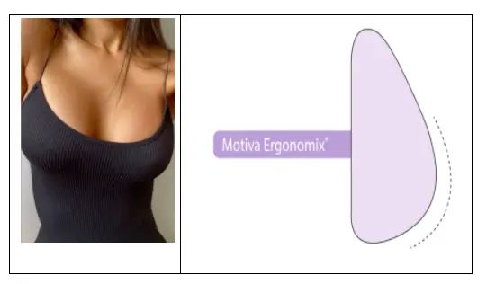 ergomix