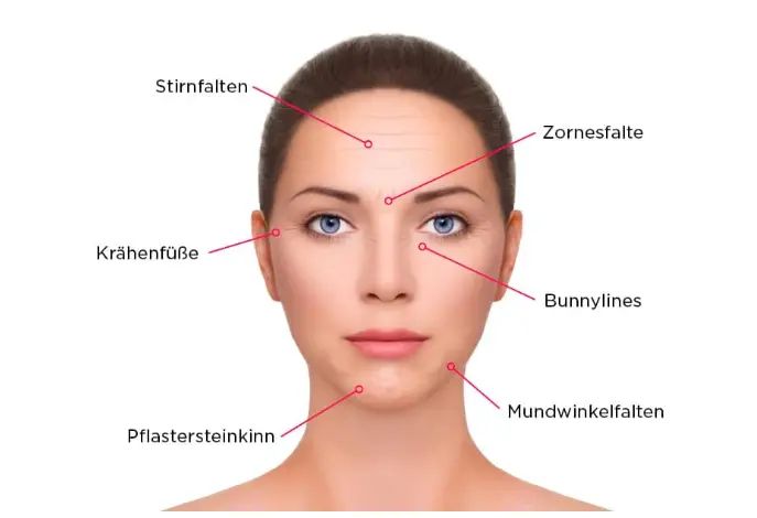 botox 2