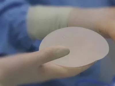 breast implants