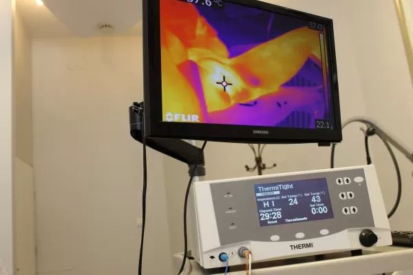 consensus thermiva