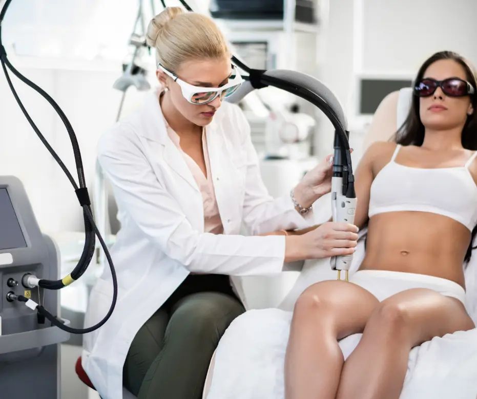 candela laser