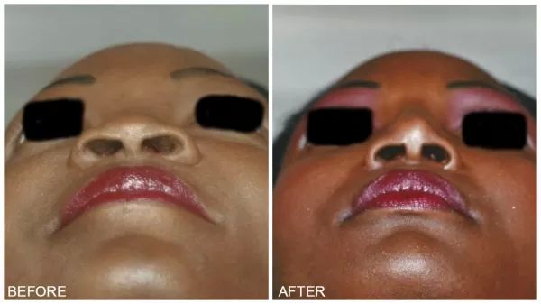 Etnique5