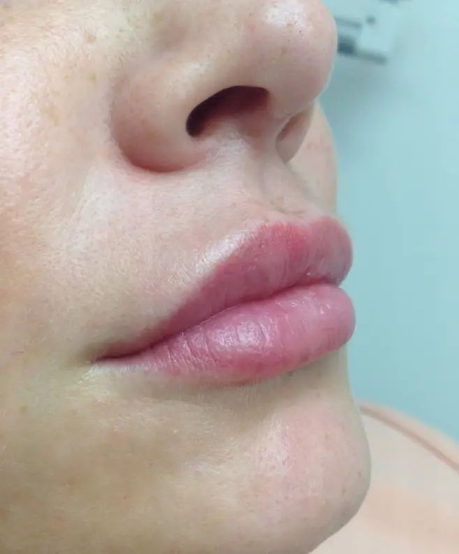 labios 6