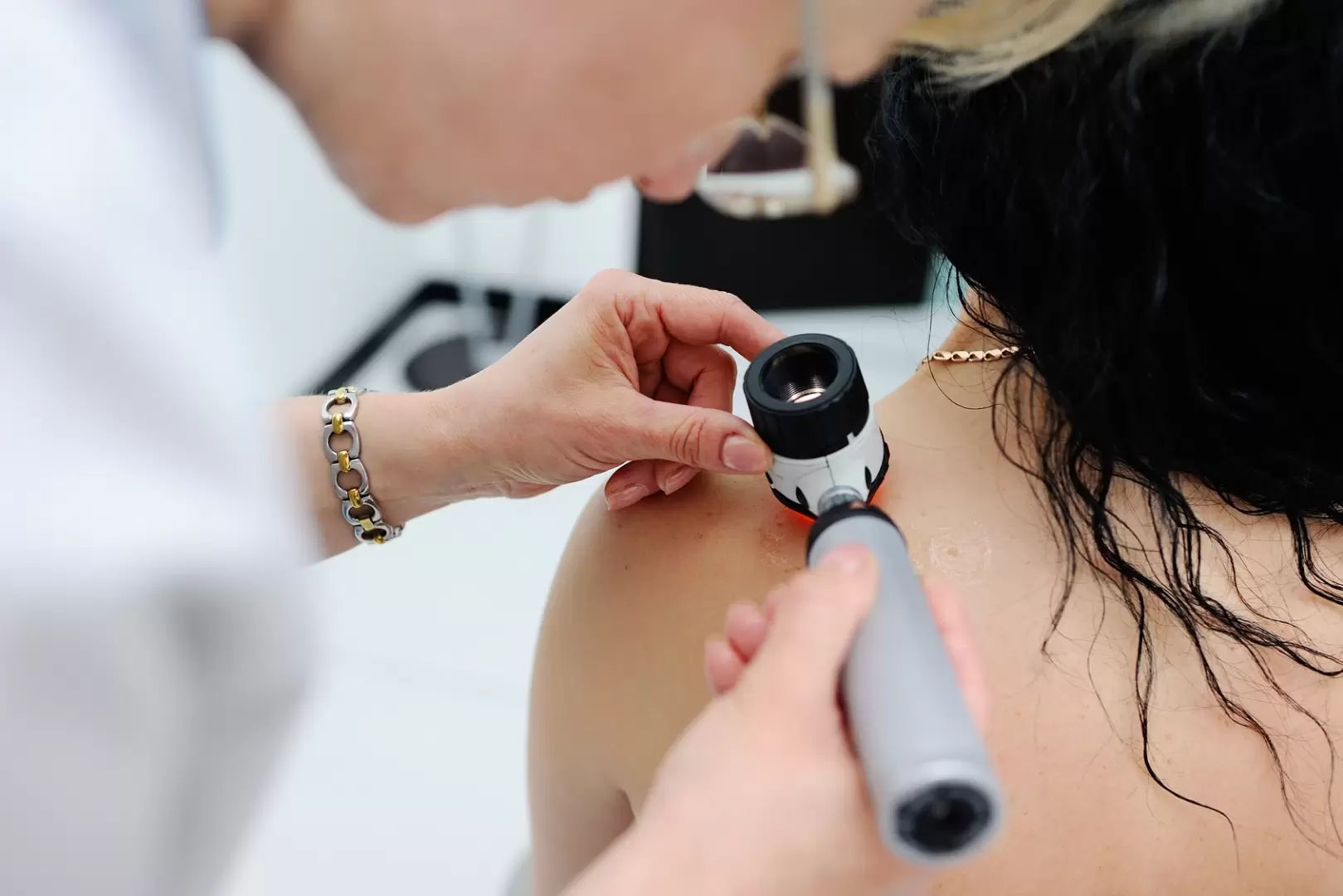 dermatologue - examiner taches brunes