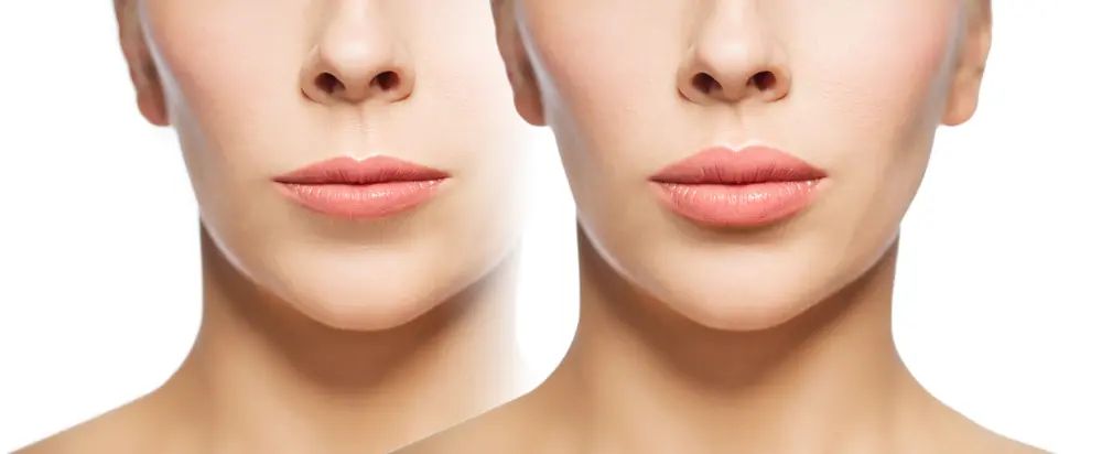 lips 6