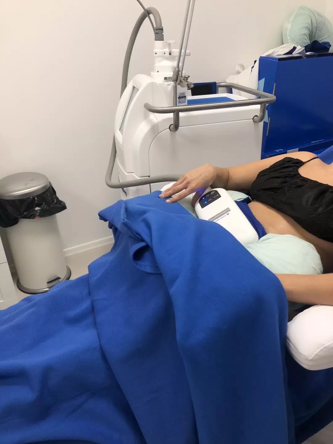 Pri kryolipolýze Coolsculpting je klient uložený na lôžko