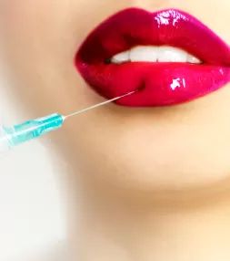 Lippenvergrößerung mit Hyaluronsäure