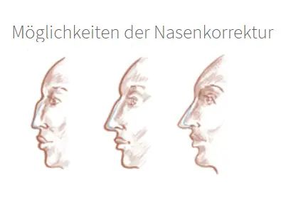 nase dr. allert
