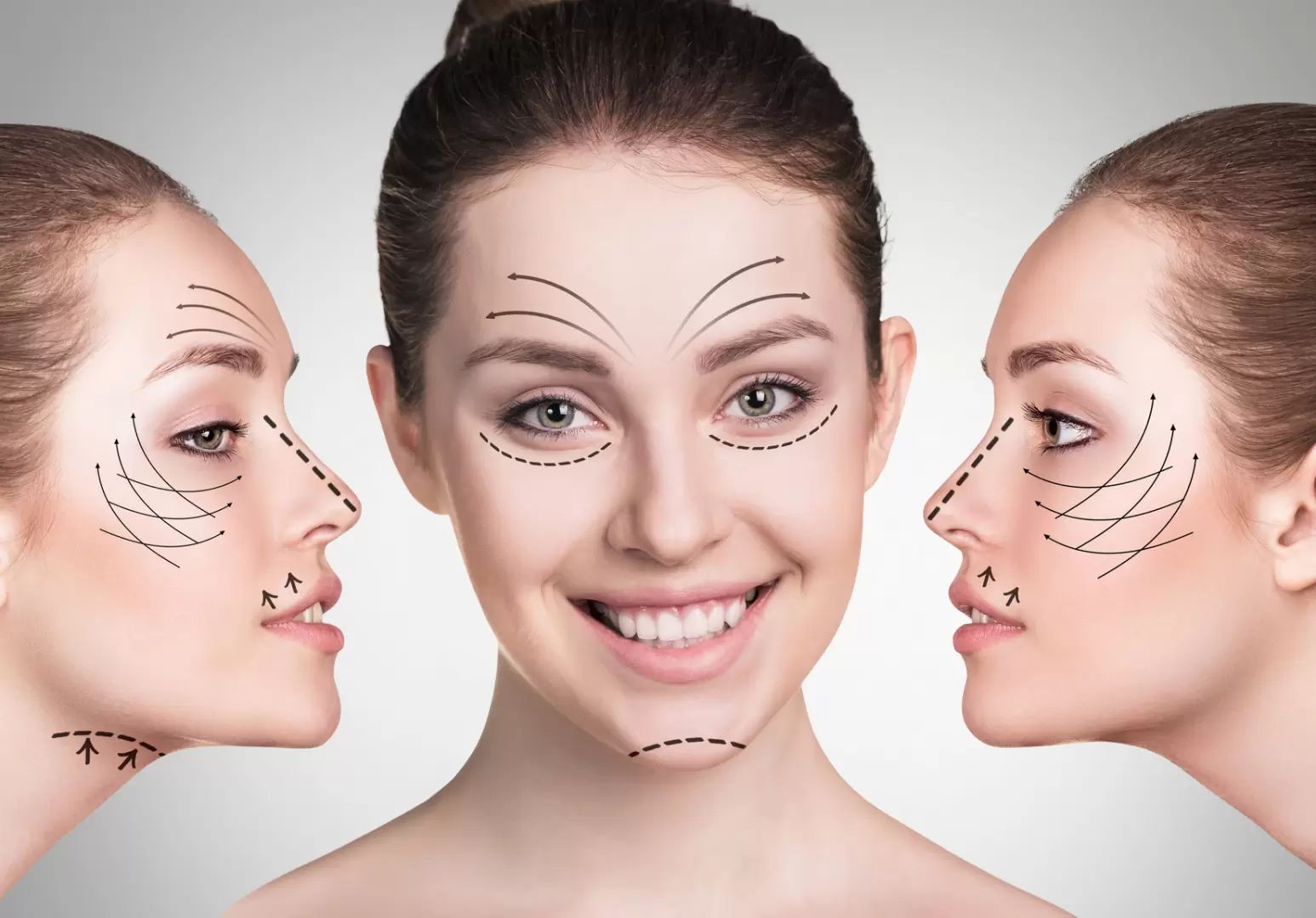 Choisissez une technique appropriée du lifting du visage en consultant un spécialiste esthétique expérimenté