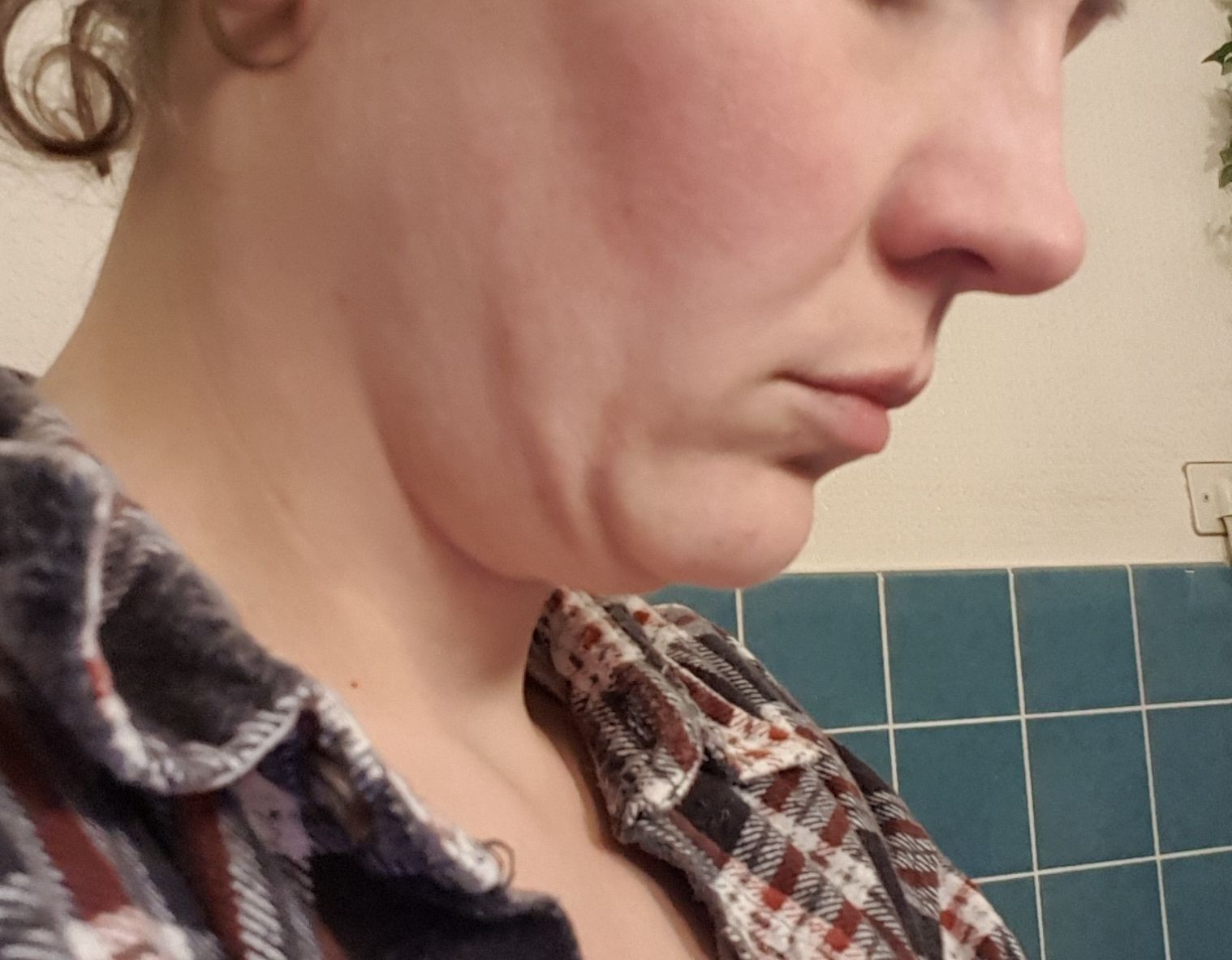 Straffung An Hals Und Mundpartie Halslifting Forum Estheticon De