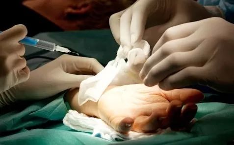 chirurgie ruky11