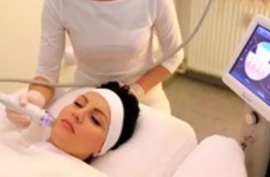 microneedling