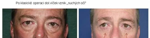 vrbicky obr5
