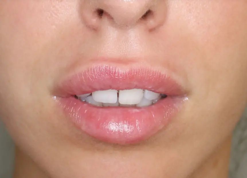 labios sattler