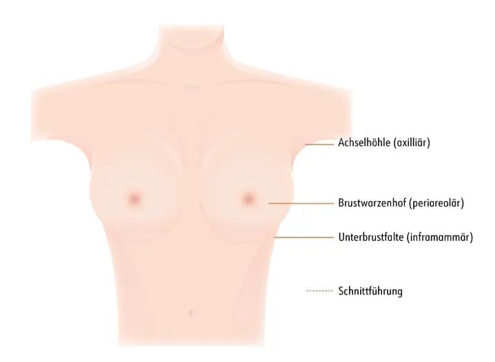 schnitttechnik