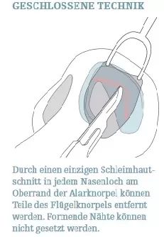 geschlossene technik 3