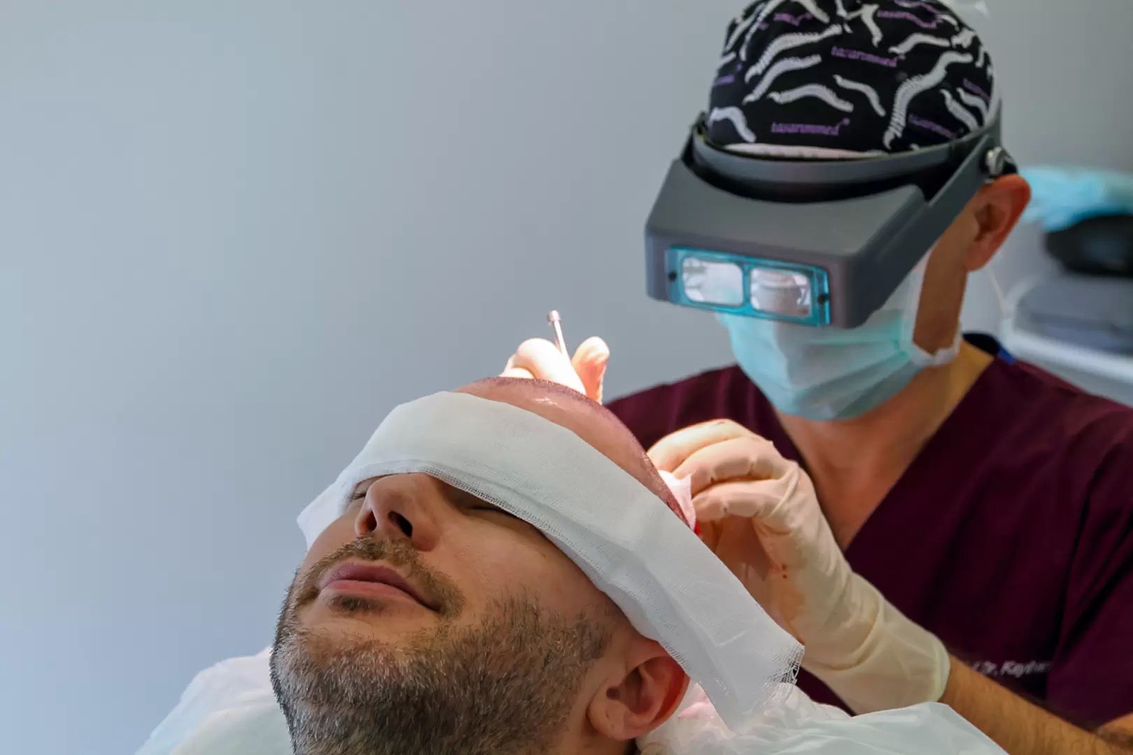 Haartransplantation