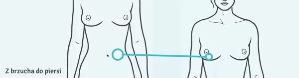 Puregraft z brzucha do piersi