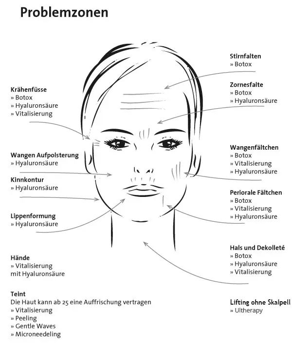 Problemzonen, Ultherapy
