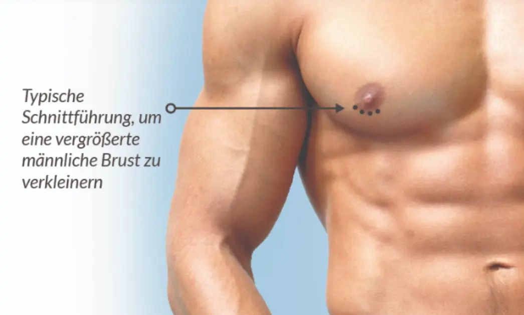 männerbrust sattler