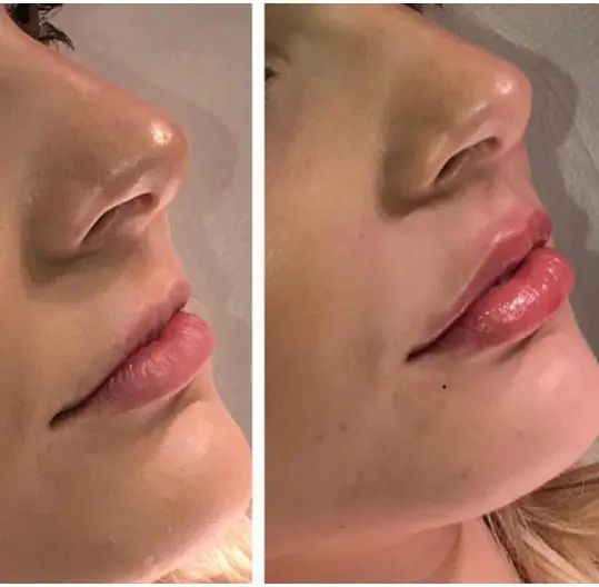 labios 5