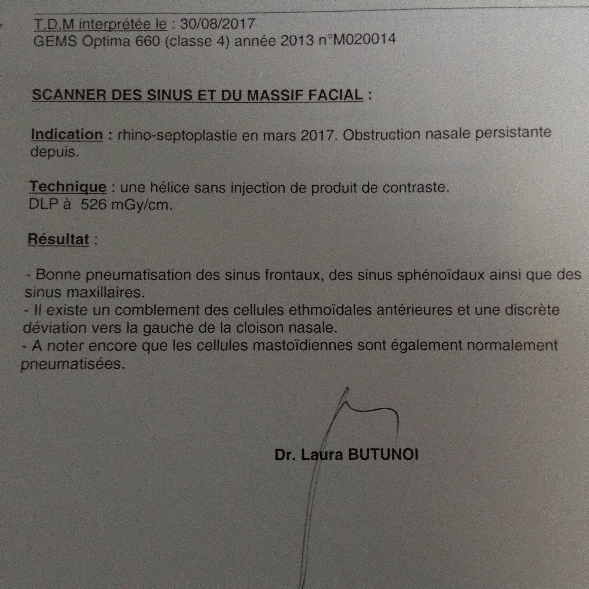 Hypertrophie des suite à rhinoplastie il y a six mois