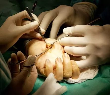 chirurgie ruky4