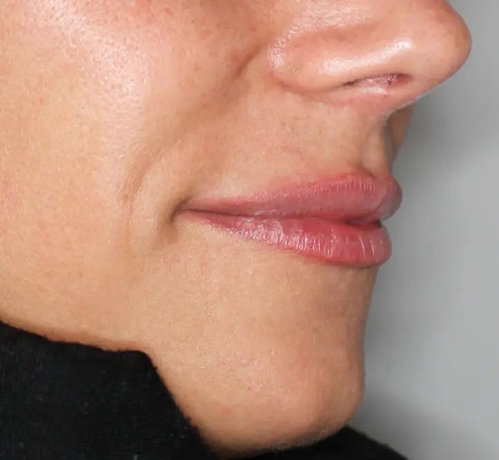 labios sattler a