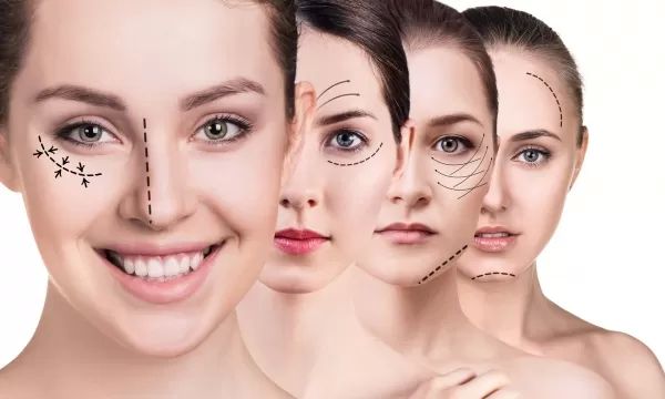 Restylane