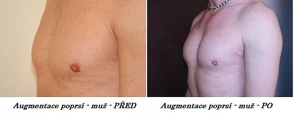 muzska prsa