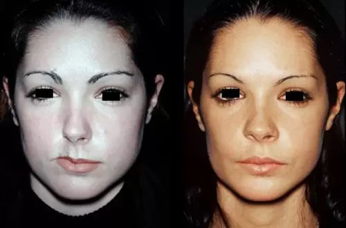 chirurgie reparatrice