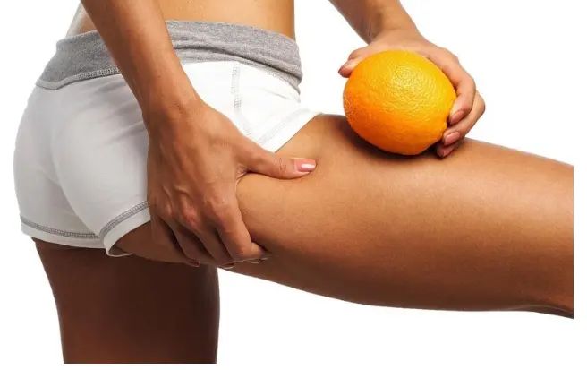 cellulite 5