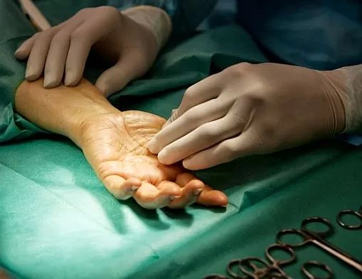 chirurgie ruky8