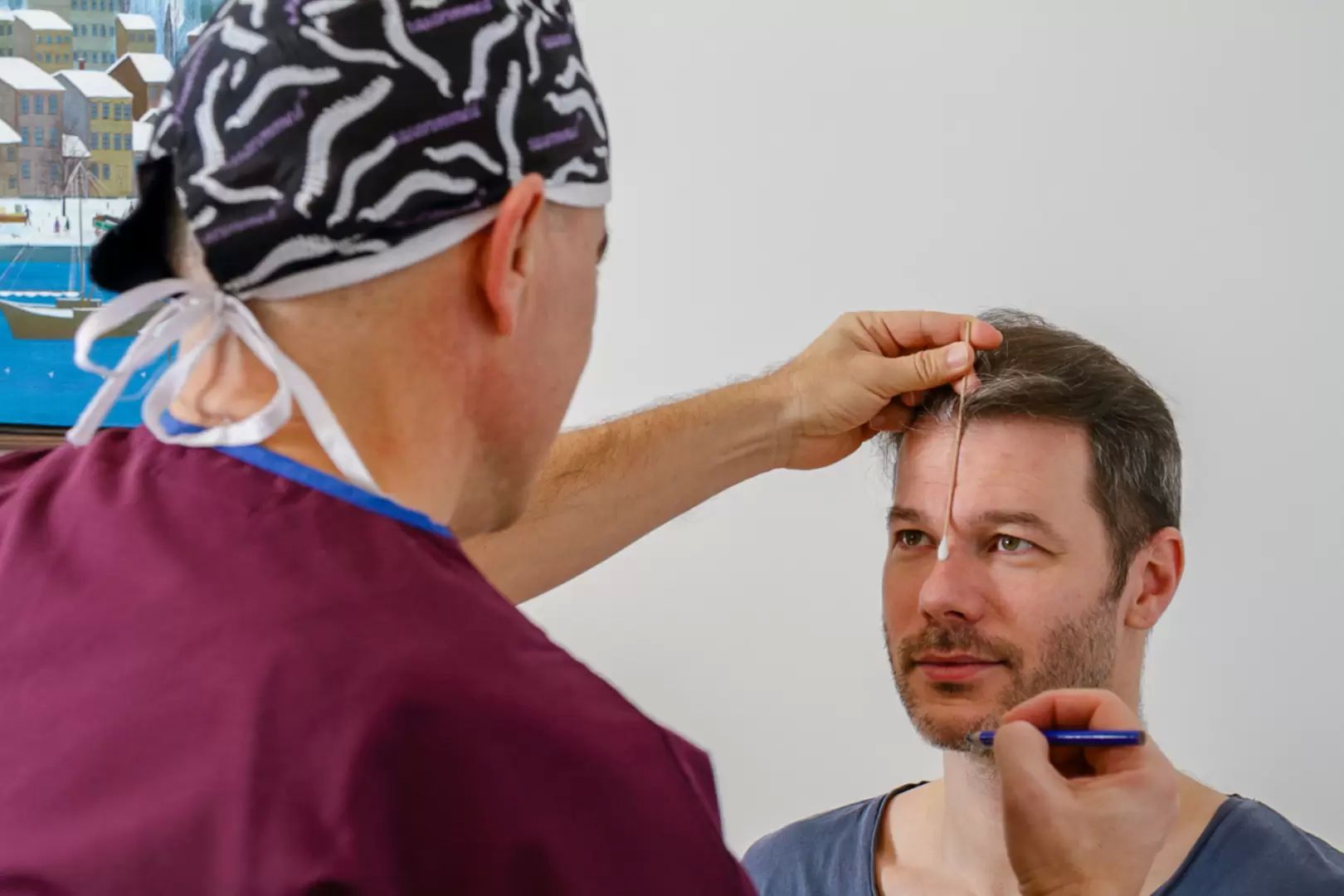 Haartransplantation