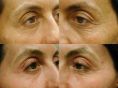 Anti aging - Foto del prima - Dott. Dario d