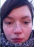 Septoplasty - Photo before - Dr. med. Jozefina Skulavik