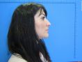 Operácia nosa (Rhinoplastika) - Fotka pred - GÉVÉ Klinika