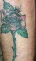 Eliminacion de tatuajes - Foto Antes de - Dra. Rocío Aracely Trujillo Aulestia
