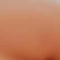 Breast Augmentation - Breast Implants - Age: 35 – 40 year old female. Photos taken 3 months post operation