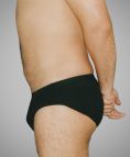 Liposukce - fotka před - OB Care