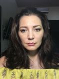 Liposucción - Paciente femenina de 43 años de edad en su tercer mes posoperatorio de eliminacion de bolsas de bichat, se puede observar como el rostro toma forma mas juvenil y triangular