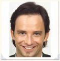 Haartransplantation - Vorher Foto - Moser Medical Group