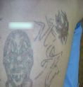 Eliminacion de tatuajes - Foto Antes de - Dr. Aristides Arellano-Huacuja