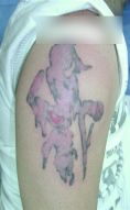 Eliminacion de tatuajes - Foto Antes de - Dr. Aristides Arellano-Huacuja