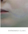 Scar removal - Photo before - Bieńkowscy Clinic®
