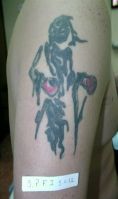 Eliminacion de tatuajes - Foto Antes de - Dr. Aristides Arellano-Huacuja