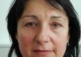 Eyelid surgery (Blepharoplasty) - Photo before - Prim. dr. sc. Davor Džepina